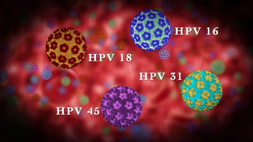 Hpv Symptoms Treatment Vaccine Hpv In Men And Women
