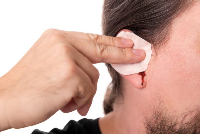 bearded man having ear bleeding