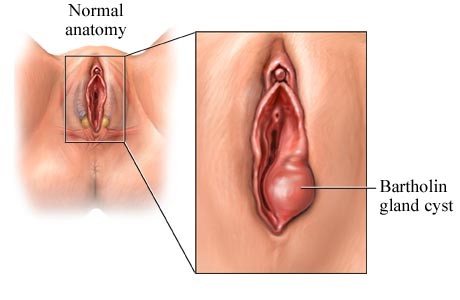 Vaginal Discoloration And Scabies