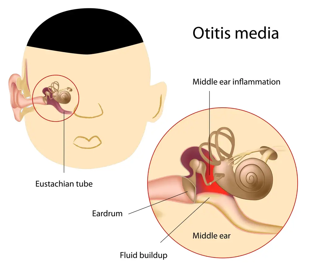 Why Are My Ears Ringing? STD.GOV Blog