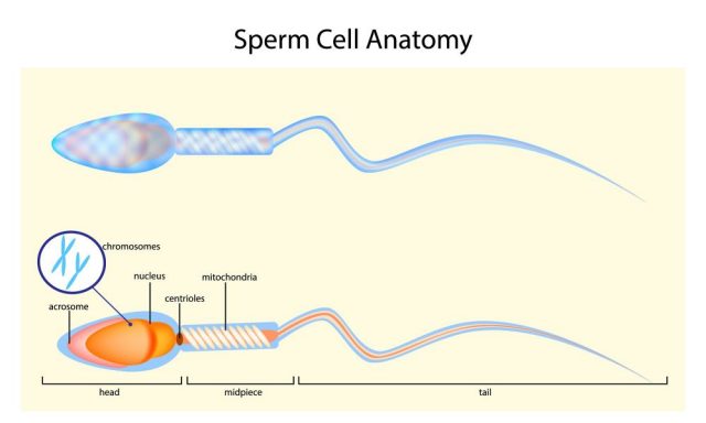 Male Infertility