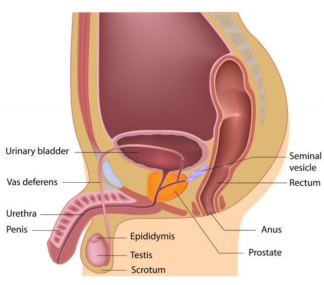 Male Infertility