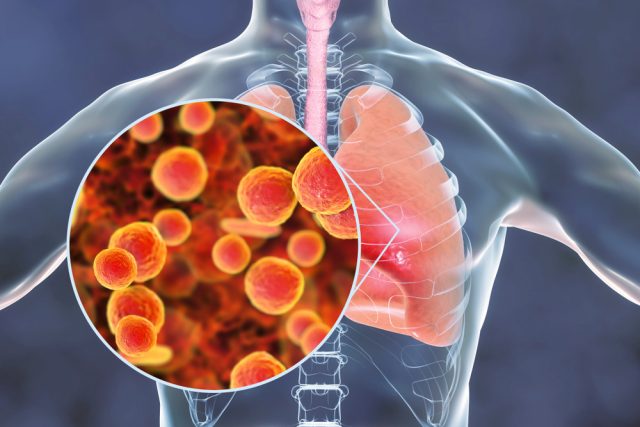 mycoplasma pneumoniae