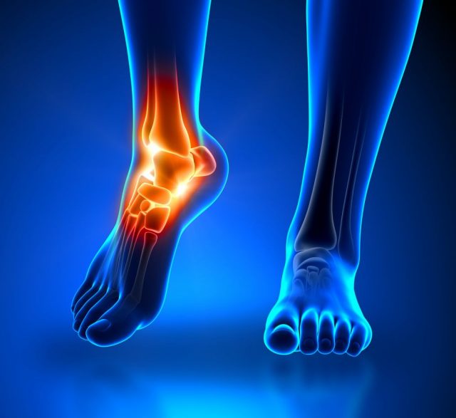 Ankle Pain