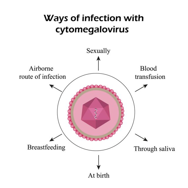 Cytomegalovirus