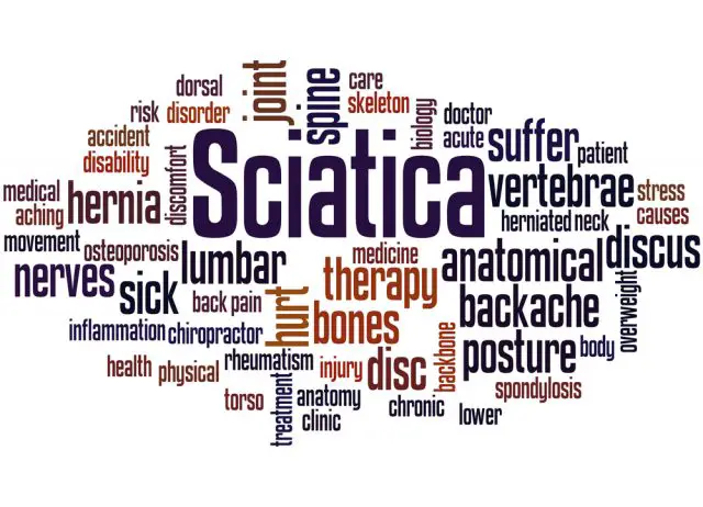 Sciatica