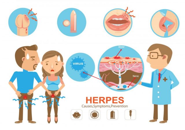 Viral STDs herpes