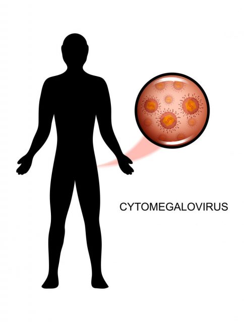 Cytomegalovirus