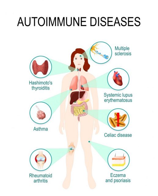 Immune System Diseases