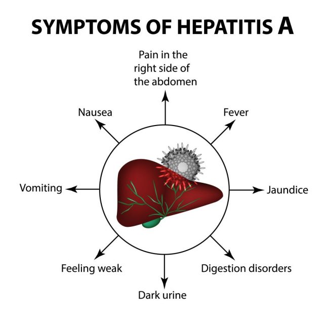 Hepatitis A