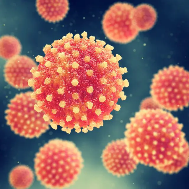 Hepatitis A