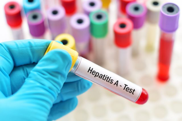 Hepatitis A