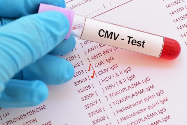 Cytomegalovirus