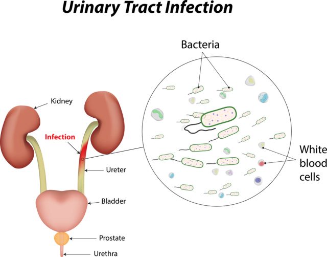 What STDs Cause Frequent Urination