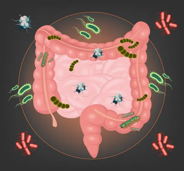 Bowel Infections