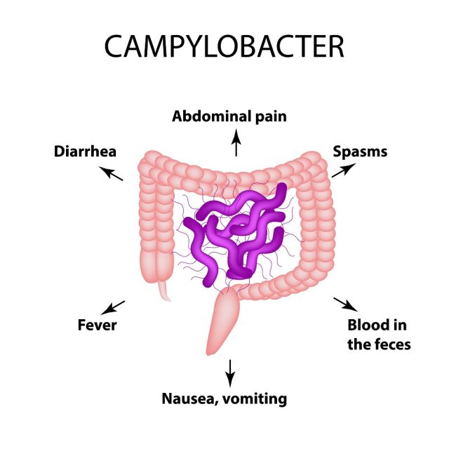 Bowel Infections