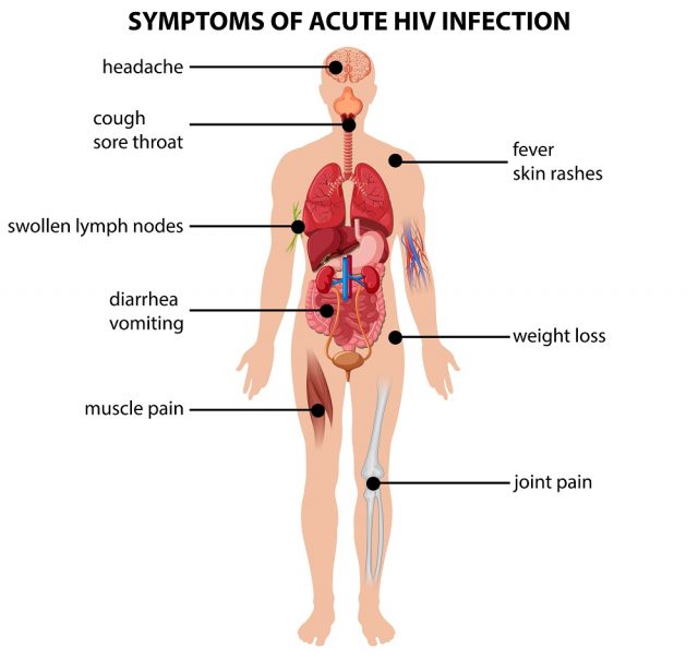 Early Symptoms of HIV