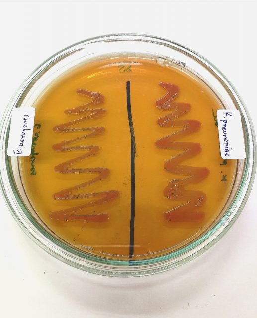 Enterobacter Cloacae