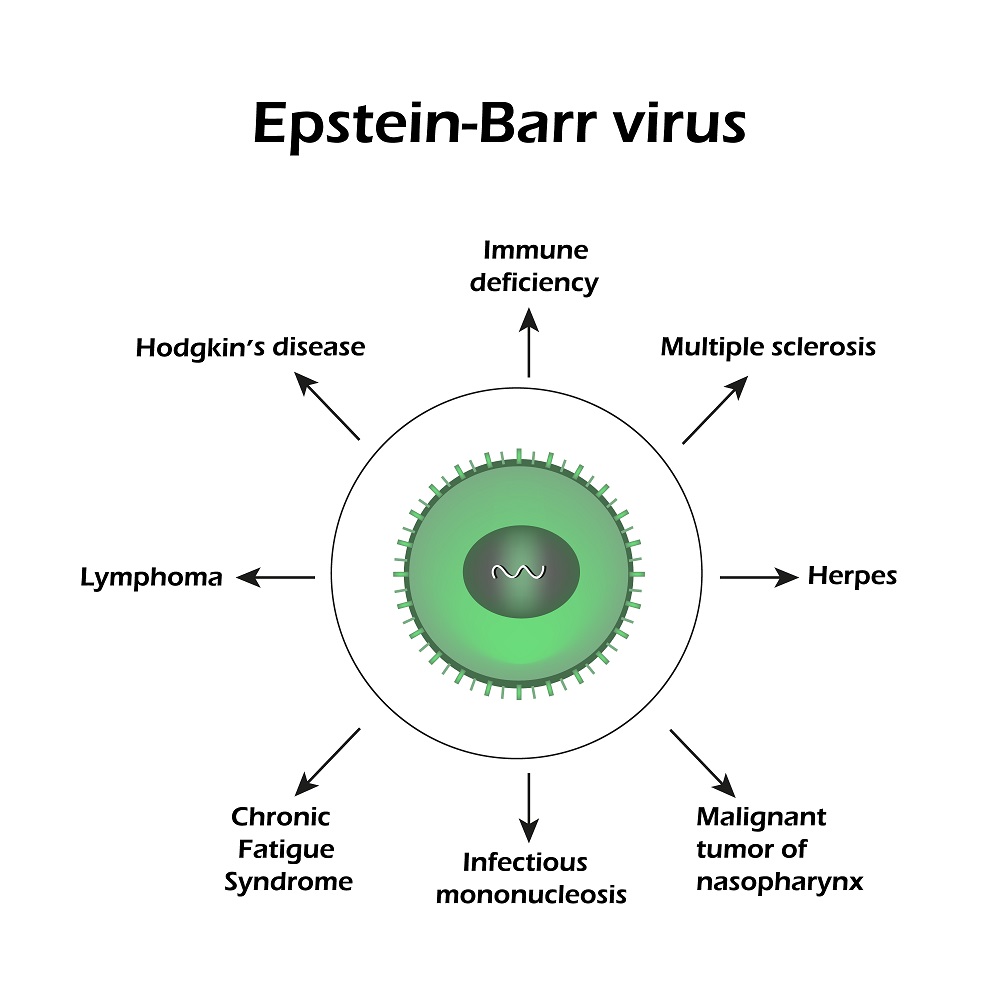 Epstein Barr Virus: Types, Symptoms, Treatment, Home Remedies | STD.GOV ...