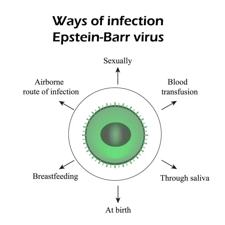 Epstein Barr Virus: Types, Symptoms, Treatment, Home Remedies | STD.GOV