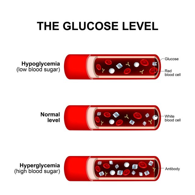 Hyperglycemia in Pregnancy