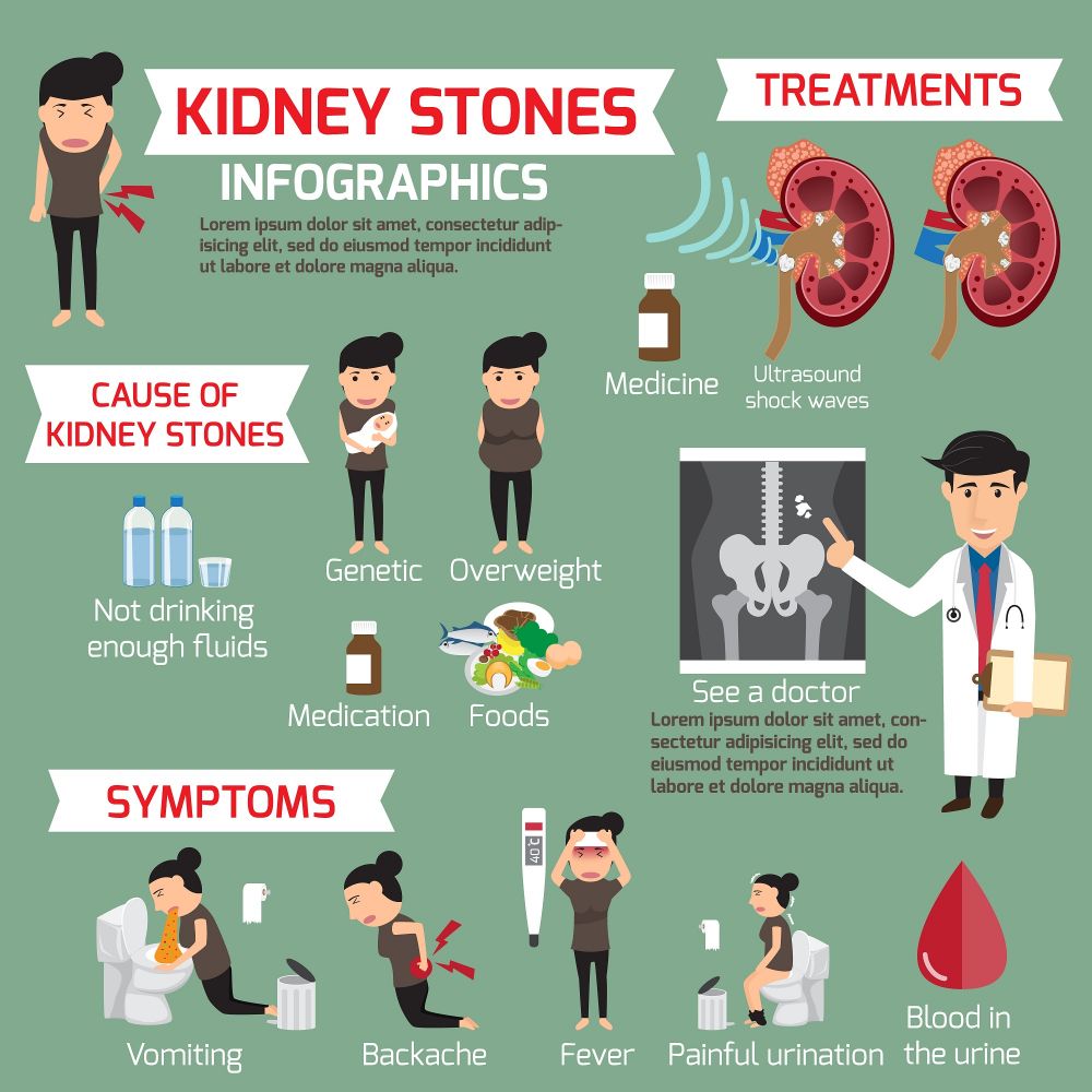 kidney stone symptoms