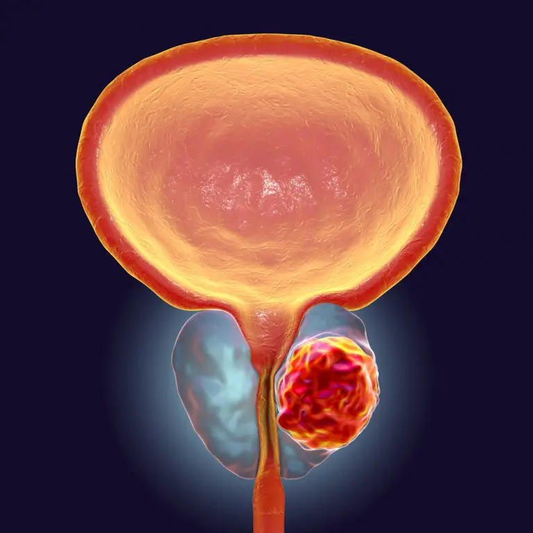 What Are the Causes of Swollen Testicles? STD.GOV Blog