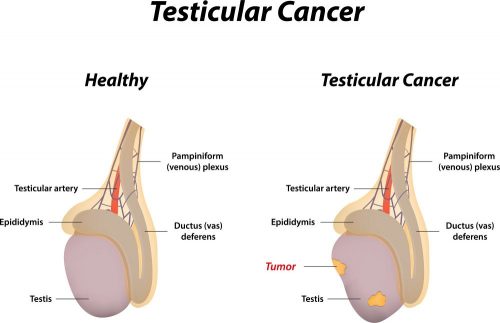 What Are The Causes Of Swollen Testicles Std Gov Blog