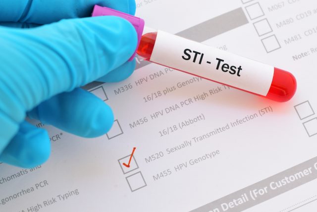 How Doctors Test for STDs