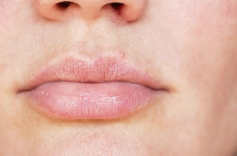 hpv lip bumps