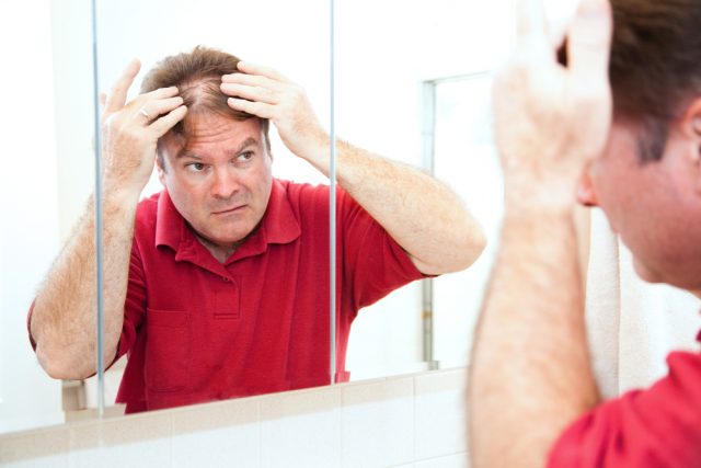 What Causes Bald Patches On The Scalp?