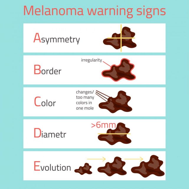 Types of Skin Cancer