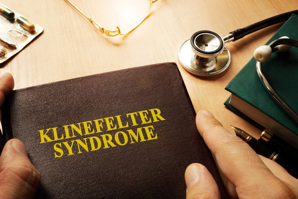Famous People With Klinefelter Syndrome