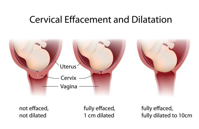 Deep pain in vagina