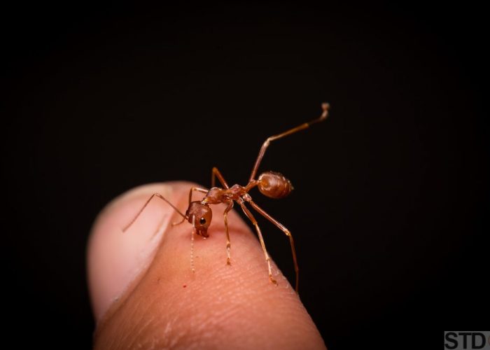 Red ant biting human skin