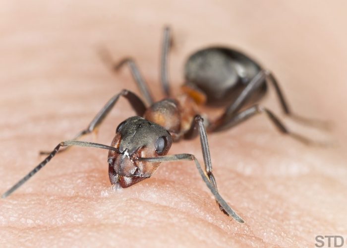 Angry ant biting human skin, extreme close-up with high magnification