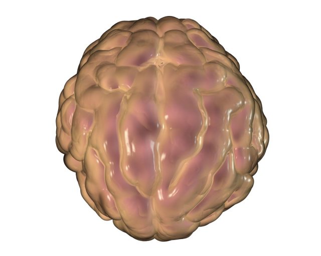 Aseptic Meningitis