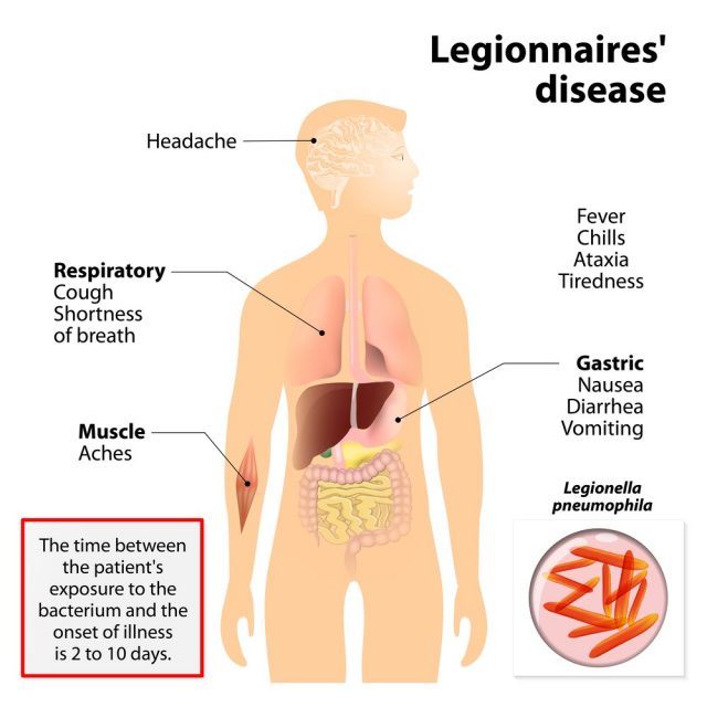 Legionnaires disease or legionellosis or Legion fever. Signs and symptoms is a form of atypical pneumonia. Human silhouette with highlighted internal organs