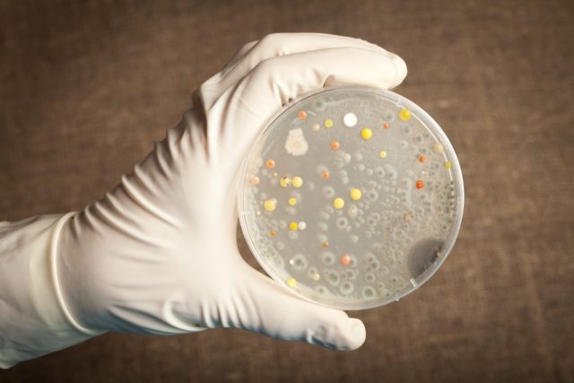 Anthrax, Bacterium, Petri Dish
