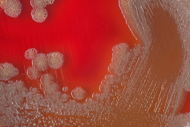 Vibrio cholerae bacterial colonies on blood agar plate