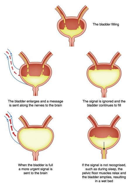 Bladder filling and nervous control of bladder as it relates to enuresis