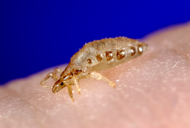 female body louse
