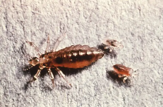 female body louse