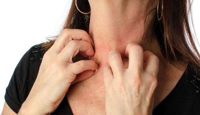 Woman scratching her neck