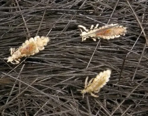 Body Lice | symptoms, diagnosis, treatment, pictures, home remedies