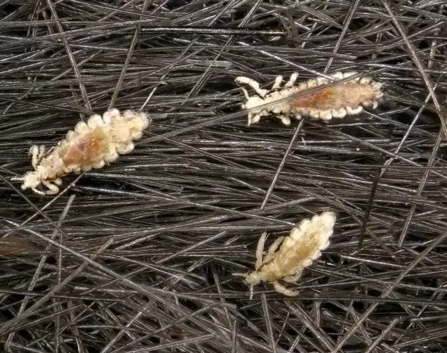 Head lice (louse) on human hair