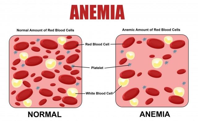 Anemia diagram