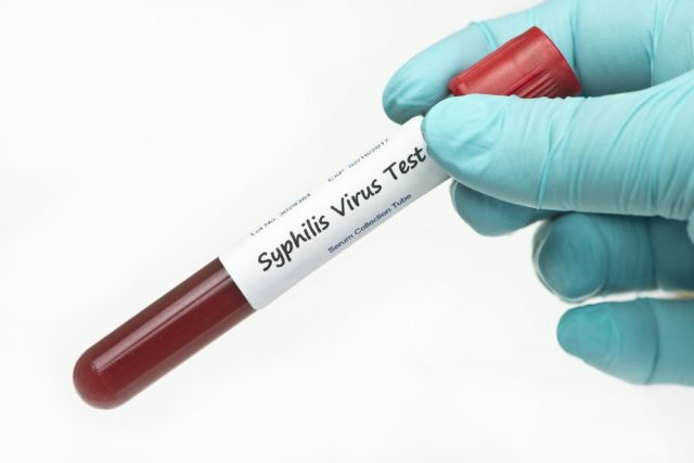 What is the right time to go for Syphilis test?