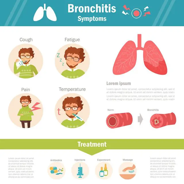 Bronchitis symptoms and treatment. Infographics