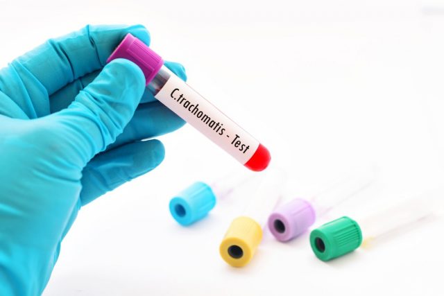 Blood sample for Chlamydia trachomatis test